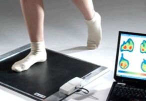 Diagnostyka palucha koślawego