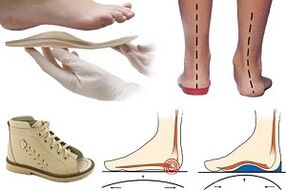 buty ortopedyczne na paluch koślawy u dziecka